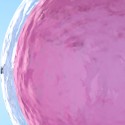 IVF
