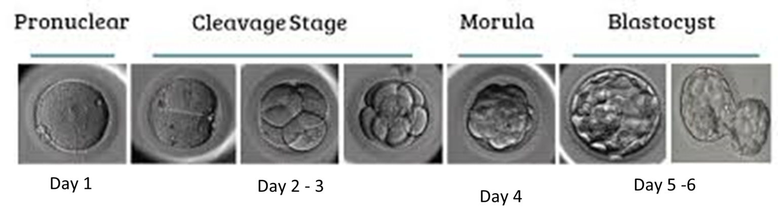 Understanding Embryo Grading • Merrion Fertility Clinic